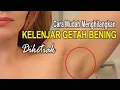 Download Lagu Cara mengobati Pembengkakan Kelenjar Getah Bening di Ketiak