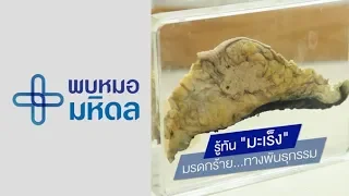 สาเหตุหลักของมะเร็งเต้านมคืออะไร และเกี่ยวข้องกับพันธุกรรมอย่างไร
