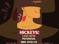 Hickeys - Love Bytes