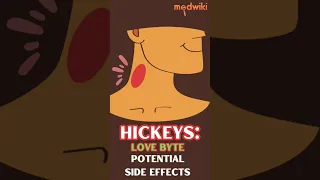 Hickeys - Love Bytes
