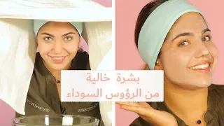 افضل طريقة لتنظيف البشرة بالبخار مع ديما 
