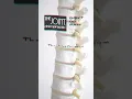 Meet Dr Millan The Power of Experience in Chiropractic Care