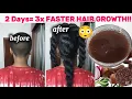 Spuit het twee dagen op je haar en je haar groeit 3 ​​keer sneller ✅
