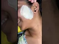 Full face waxing by Rica Brazilian wax Facial hair removal tutorial
