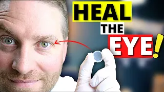 Download Amniotic Membrane For Dry Eye (And More AMAZING Eye Healing Properties!) MP3