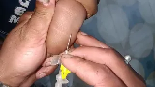 How to Insert a Cannula|How to Insert an IV Cannula|The Correct Method for Cannula Insertion|2026✅✅✅
