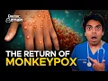 Mpox Monkeypox Global Emergency Doctor Explains Symptoms Risk Vaccines 2024