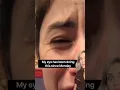 Doctor explains random eye twitching
