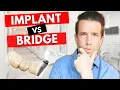 Lagu Dental Implants vs Bridges for a Missing Tooth