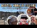 Getting Dental Work in Mexico Everything You Need to Know Los Algodones FAQ
