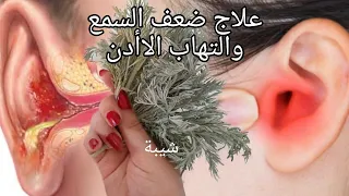 معجزة عشبة الشيبة في علاج إلتهاب الأذن بأسرع مما تتوقع نظف أذنك بهذه الطريقة طبيعية للكبار والصغار  معجزة عشبة الشيبة في علاج إلتهاب الأذن بأسرع مما تتوقع نظف أذنك بهذه الطريقة طبيعية للكبار والصغار