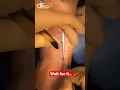 Download Lagu Satisfying incision making! #shorts #satisfying