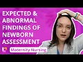 Expected and Abnormal Findings of Newborn Assessment - Maternity Nursing