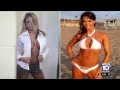 Breast Implant Safety