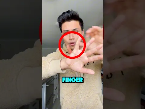 He Did WHAT To His Finger?! 🖐️😟