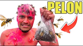 Las Avispas Me Tumbaron El Pelo ☠️ (BROMA) - Andrés WG