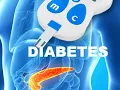 ICD-10-CM Coding for Diabetes