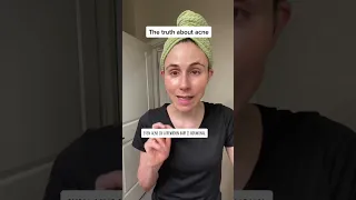 The truth about hormonal acne DrDrayzday