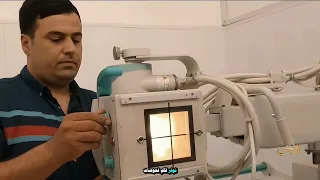 اشعة وعيادة ابو انور بلدروز دندنها