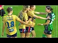 Shocking Fouls & Painful Injuries in Women's Soccer 😨⚽🩸