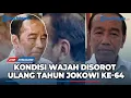 Download Lagu 🔴 LIVE : Kondisi Wajah Jokowi Disorot saat Warga Solo Rayakan Ulang Tahun Jokowi Ke-64 Bersama