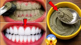 सिर्फ 2 मिनटों में पीले गंदे दांतों को मोती की तरह चमका देगा ये नुस्खा | White Teeth home remedy