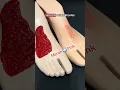 Download Lagu Kenali tanda-tanda lukamu sudah sembuh.