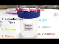 Semen Analysis Test Lab Liquefaction time Volume Colour pH Odour Viscosity Test