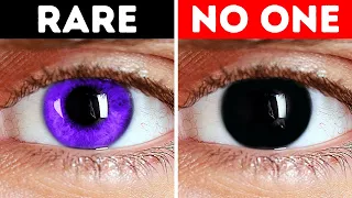 That S Why People Don T Have Black Eyes Never Ever  That S Why People Don T Have Black Eyes Never Ever