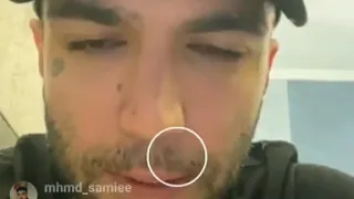 کتک خوردن ساشا توسط حصین 