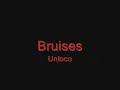 unloco = bruises