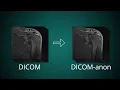 How to Anonymize DICOM images edit DICOM tags