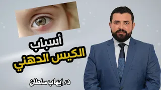 اسباب الكيس الدهني في الجفن د إيهاب سلطان 
