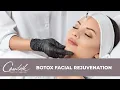 Dr Lisa Cassileth Performs a Non-Surgical Filler and Botox Facial Rejuvenation