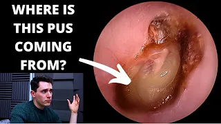 Download Something Is Very Wrong With This Ear...... (Differential Diagnosis) MP3