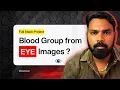 Blood Group Detection with Eye Images Machine Learning Projects 2025 Final year Projects