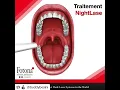 Nightlase Stop Snoring Laser Sydney CBD Wahroonga Canberra by MD Cosmedical Solutions Clinics