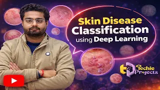 Skin Disease Classification using Deep Learning Machine Learning Projects for Final Year