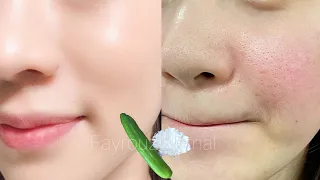 Starch And Cucumber You Will Not Believe The Results Whitening The Skin In Seconds 