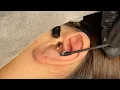 ASMR Ear Cleaning | This is the Most Earwax Yet