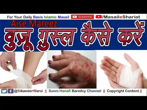 खुजली | ज़ख्म | और पट्टी पर वुज़ू ग़ुस्ल | Jism Par Daane, Patti Ho To Wuzu Kaise Karenn