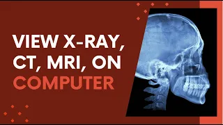 how to open x ray mri u0026 ct scan dcm files on windows computer dicom viewer