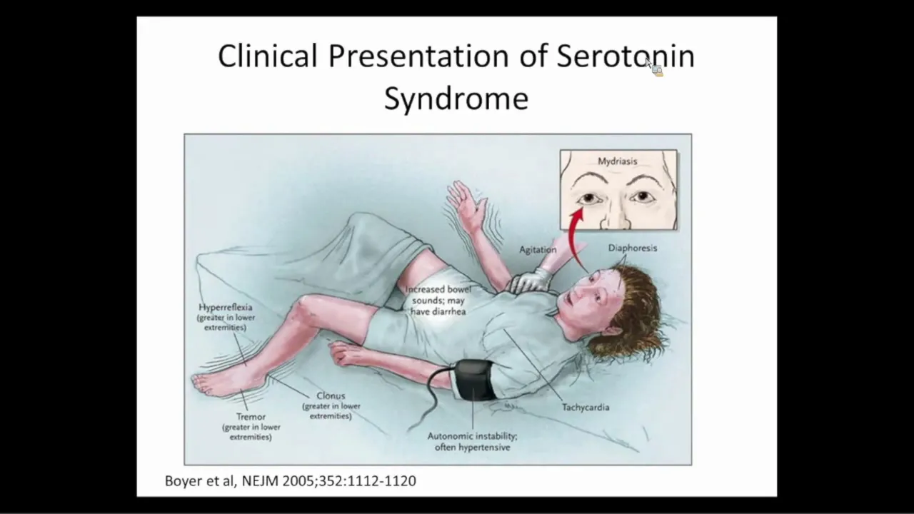 Consult Psychiatry Emergencies: A Review of Medication Toxicity Syndromes and Catatonia