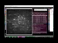 Imagej based ROI Drawing for 2 Photon Calcium Imaging Preprocessing
