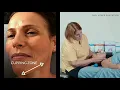 Massage Cupping - Facial Rejuvenation