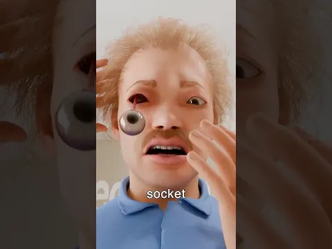 Could You Pop Out Your Eyeball 😱