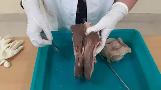 gross anatomy of female external genital organ