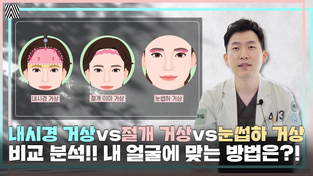 쌍꺼풀 상담하러 갔는데, "내시경 이마 거상"을 추천?! 내시경 거상 vs 절개 거상 vs 눈썹하 거상의 장·단점 분석!! 내시경 눈썹 이마 거상 2편_[4월31일 성형외과]