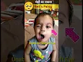 Download Lagu Bell's Palsy in Child #shorts #physiodrdeepaksoni #bellspalsy