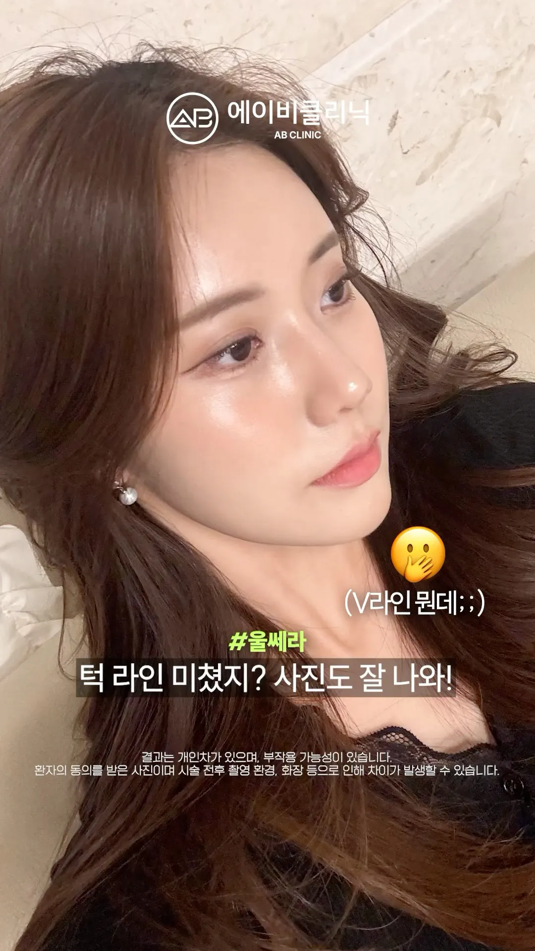 20대 추천 시술 🩷